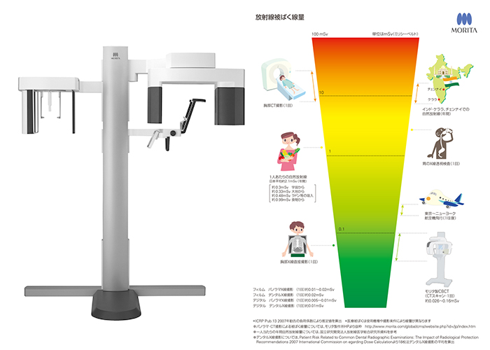 デジタルレントゲン